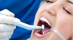 חסרונות של השתלות שיניים