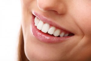 ציפוי שיניים emax מחיר
