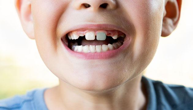 שן אפורה לילד